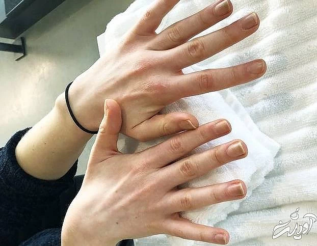 پاک کردن ژل از ناخن بررسی ناخن ها